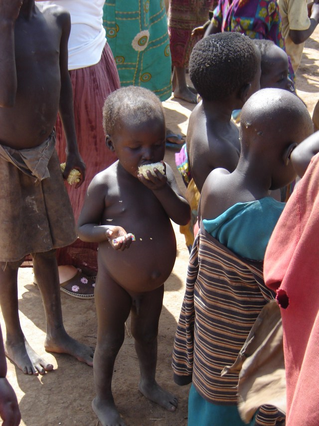 DSC00853 Distended bellies = malnutrition & hunger
